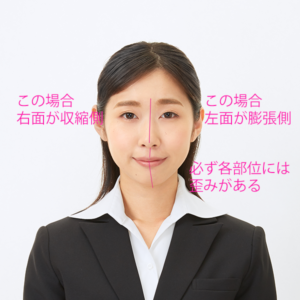 証明写真 での 顔 の 左右非対称 と 雌雄眼 についての解説写真