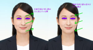 左右非対称・雌雄眼の気になる方へ。自信を持って提出できる証明写真