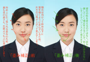 左右非対称 の 歪み補正 BEFORE vs. AFTER